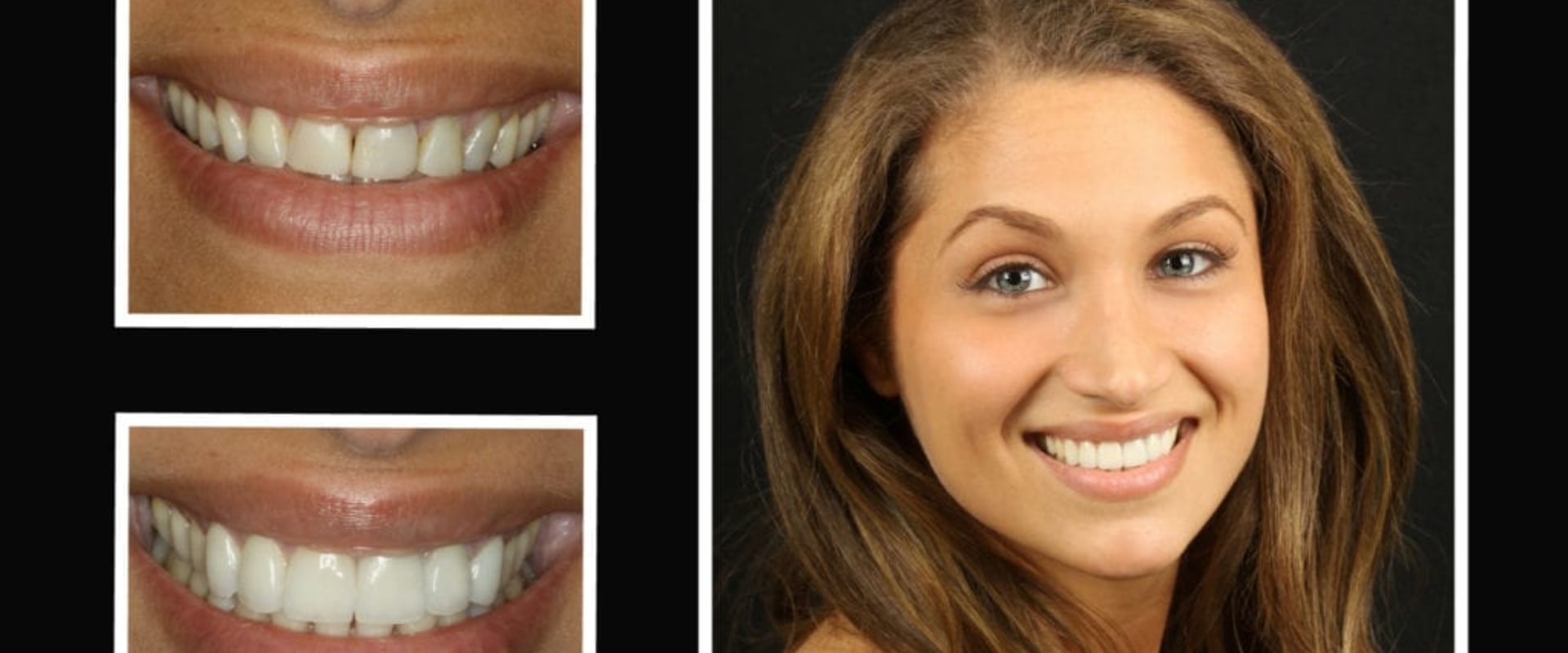 A Comprehensive Guide to Smile Makeovers