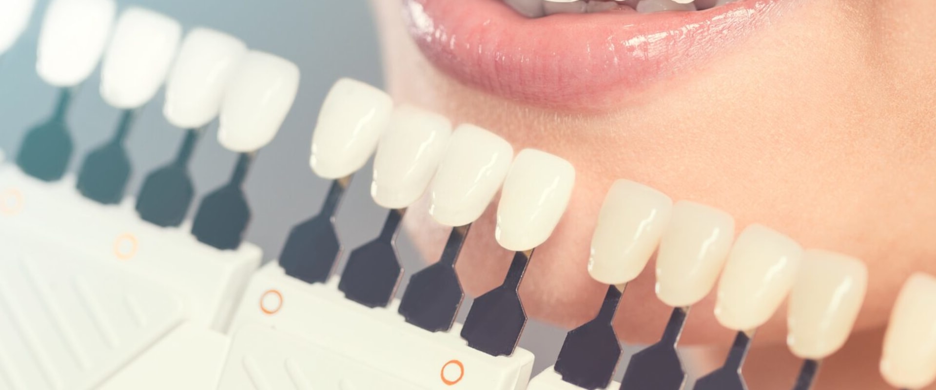 A Comprehensive Guide to Smile Makeovers