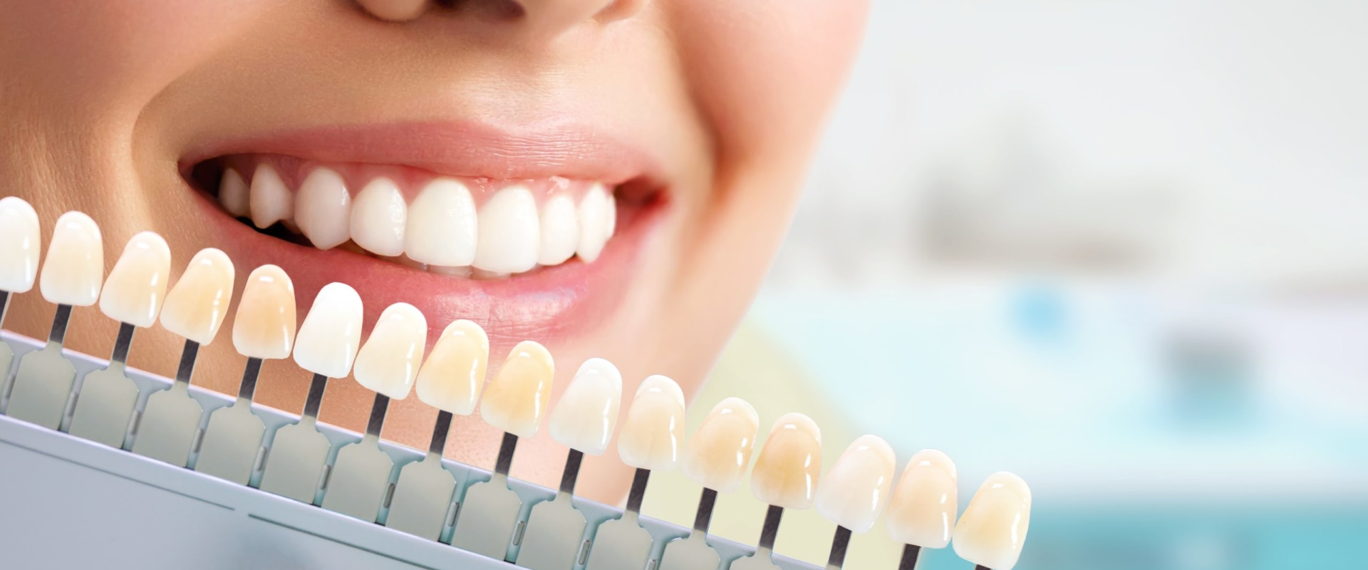 Crafting Brilliance: The Role Of Dental Services In Spring Branch Smile Makeovers