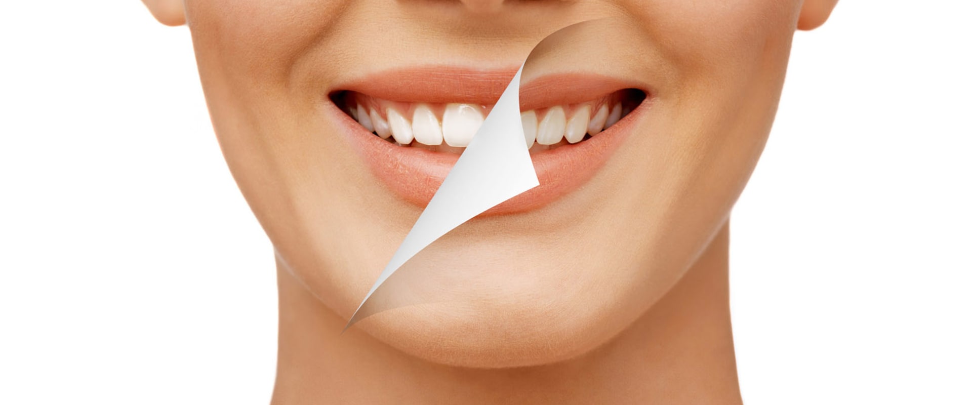 Smile Design vs Smile Makeover: What's the Difference?