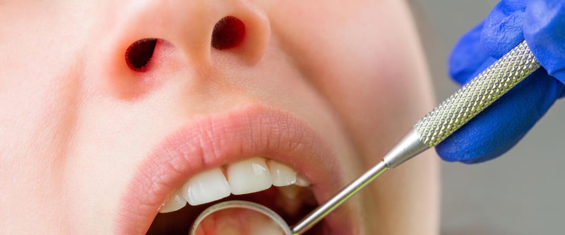 5 Questions to Ask Your Dentist Before Getting a Smile Makeover