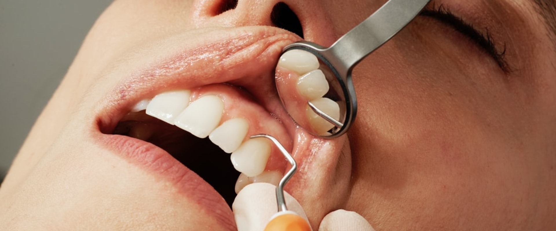 Transform Your Smile With A Smile Makeover: Cosmetic Dentistry In Manassas Park, VA