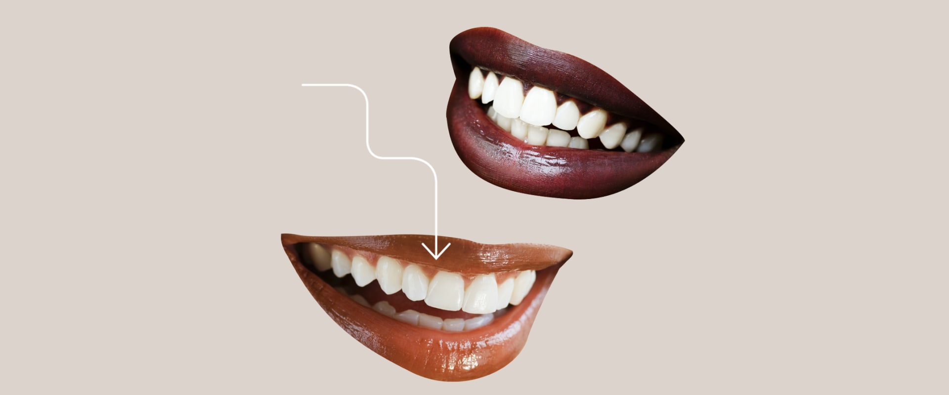 What Age is Best for a Smile Makeover?