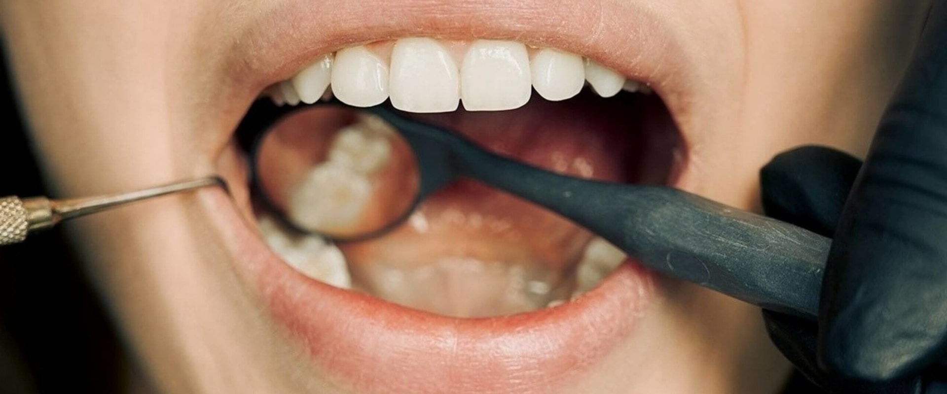 Texas Smiles Transformed: A Deep Dive Into Comprehensive Dentistry For The Ultimate Smile Makeover