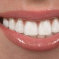 Achieve The Perfect Smile: How A Dentist In McGregor, TX Can Help You With A Smile Makeover