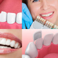 Financing Options for a Smile Makeover