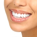 From Ordinary To Extraordinary: How Dental Services In Austin, Texas, Can Elevate Your Smile Makeover