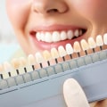 Crafting Brilliance: The Role Of Dental Services In Spring Branch Smile Makeovers