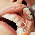 Transform Your Smile With A Smile Makeover: Cosmetic Dentistry In Manassas Park, VA