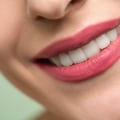 Smile Makeovers In San Antonio: The Role Of Dental And Cosmetic Dentistry