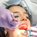 From The Inside Out: Endodontic Expertise In Crafting Your Perfect Smile Makeover In San Antonio, TX