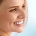 Smile Makeover: A Comprehensive Guide to Achieving a Harmonious and Beautiful Smile