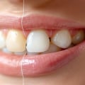 Why Smile Makeovers Are About More Than Cosmetic Enhancements