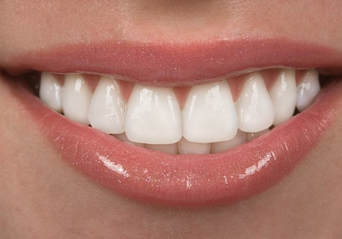 Achieve The Perfect Smile: How A Dentist In McGregor, TX Can Help You With A Smile Makeover