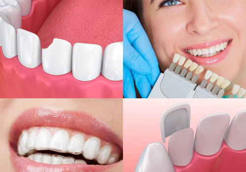 Financing Options for a Smile Makeover