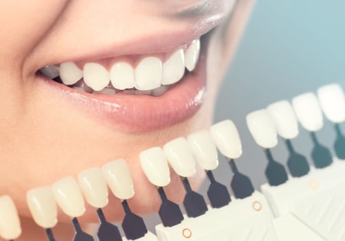 A Comprehensive Guide to Smile Makeovers