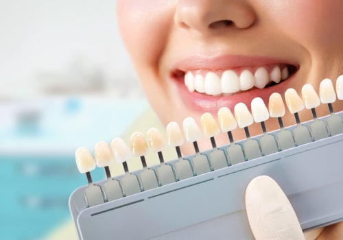 Crafting Brilliance: The Role Of Dental Services In Spring Branch Smile Makeovers