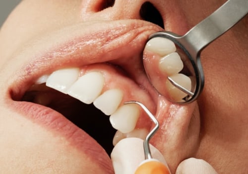 Transform Your Smile With A Smile Makeover: Cosmetic Dentistry In Manassas Park, VA