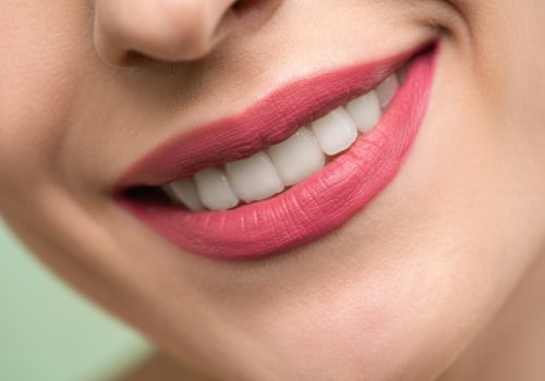 Smile Makeovers In San Antonio: The Role Of Dental And Cosmetic Dentistry