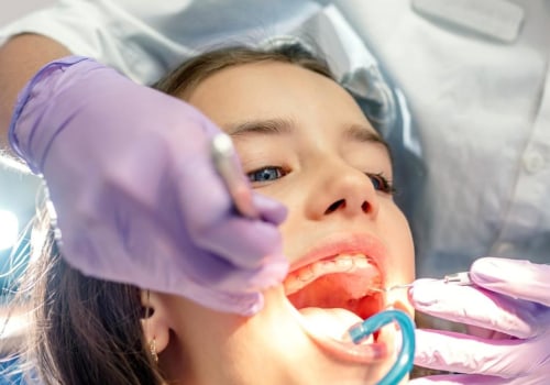From The Inside Out: Endodontic Expertise In Crafting Your Perfect Smile Makeover In San Antonio, TX
