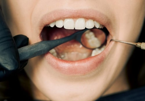 Texas Smiles Transformed: A Deep Dive Into Comprehensive Dentistry For The Ultimate Smile Makeover